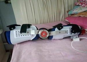 假肢矯形器價(jià)格解析與蕪湖德康假肢矯形器服務(wù)介紹