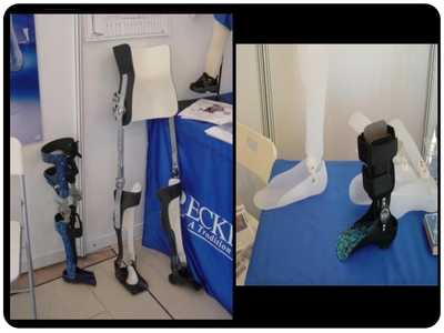 假肢與矯形器 功能、技術(shù)與應(yīng)用概述